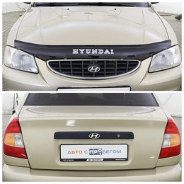 Седан Hyundai Accent 2005 года, 470000 рублей, Обнинск